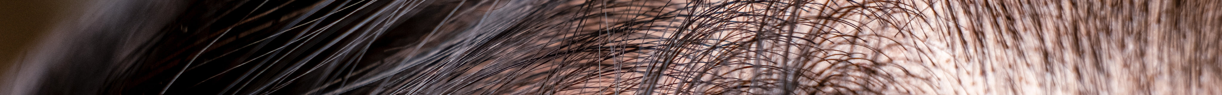 hair-loss-and-thin-2025-01-09-19-56-08-utc.jpg
