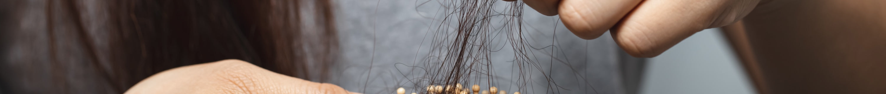 women-have-hair-loss-problems-2024-10-18-04-23-43-utc.jpg